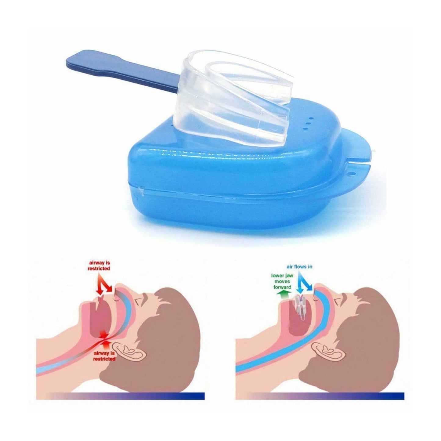 Social Hike 3x Anti Snoring Aid Nose Clips - Sleep + Breathing Device